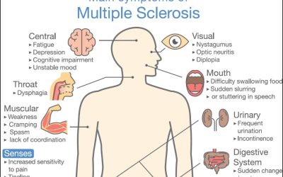 Yoga Therarpy for Multiple Sclerosis Symptom Management